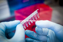 Robert Witkowski taps treated saliva samples for ease of pipetting the samples to the PCR plate for 